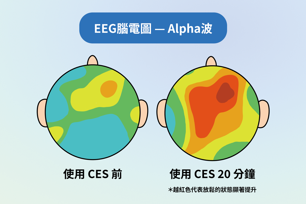 EEG 腦電圖 Alpha 波研究示意
